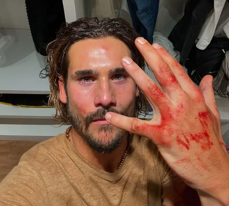 Mania de Você: Nicolas Prattes revela detalhes de cena em que saiu machucado